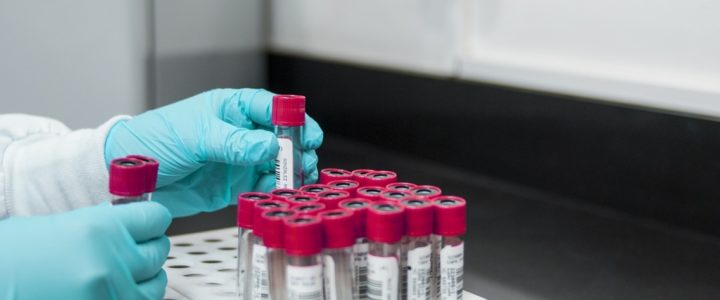 monkey dong lab testing